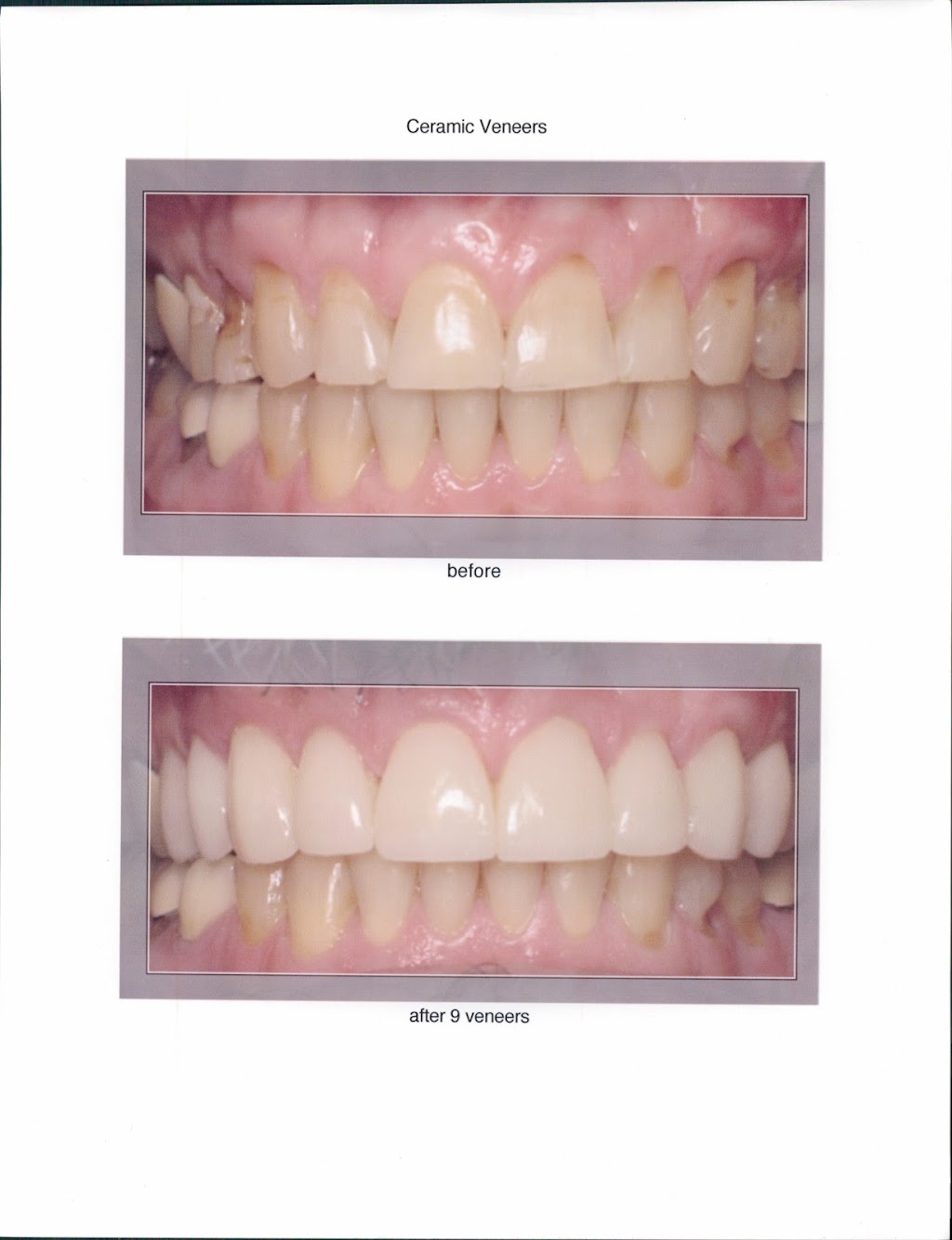 Precision Dental Lab Inc | 1403 Foulk Rd #107, Wilmington, DE 19803 | Phone: (302) 478-5608