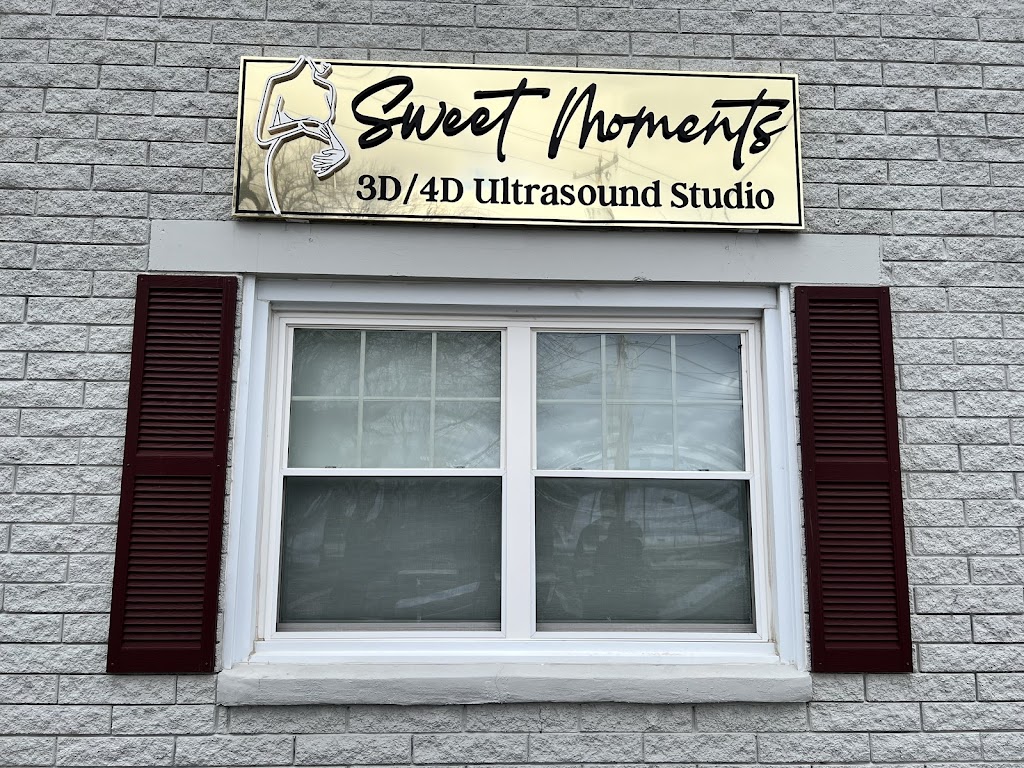 Sweet Moments 3D/4D Ultrasound Studio | 246 Montcalm St STE 2C, Chicopee, MA 01020 | Phone: (413) 566-6062