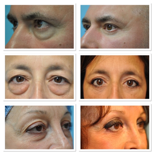 Janjua Facial Surgery | 2345 Lamington Rd #108, Bedminster, NJ 07921 | Phone: (908) 470-2600