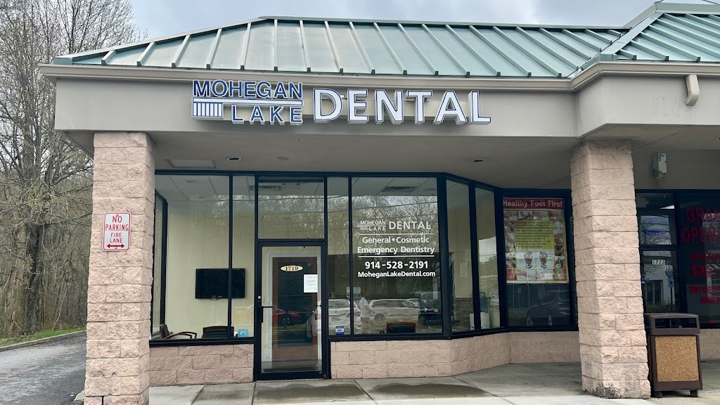 Mohegan Lake Dental PC | 1719 E Main St, Mohegan Lake, NY 10547 | Phone: (914) 528-2191