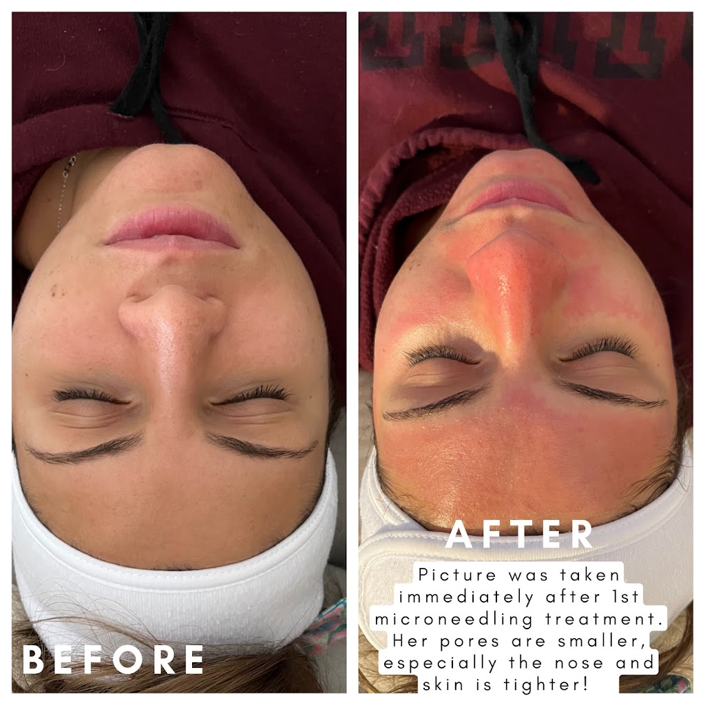 Skin Perfect By Dayna | 345 Heather Ct, Yorktown Heights, NY 10598 | Phone: (914) 215-0197