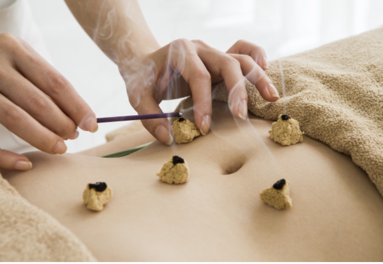 Impulse Acupuncture and Massage PC | Birch Hill Rd, Mt Sinai, NY 11766 | Phone: (631) 601-4815