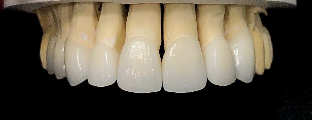 Synergy Dental Ceramics By Roberto Rossi | 700 Hillside Avenue, New Hyde Park, NY 11040 | Phone: (516) 877-8089