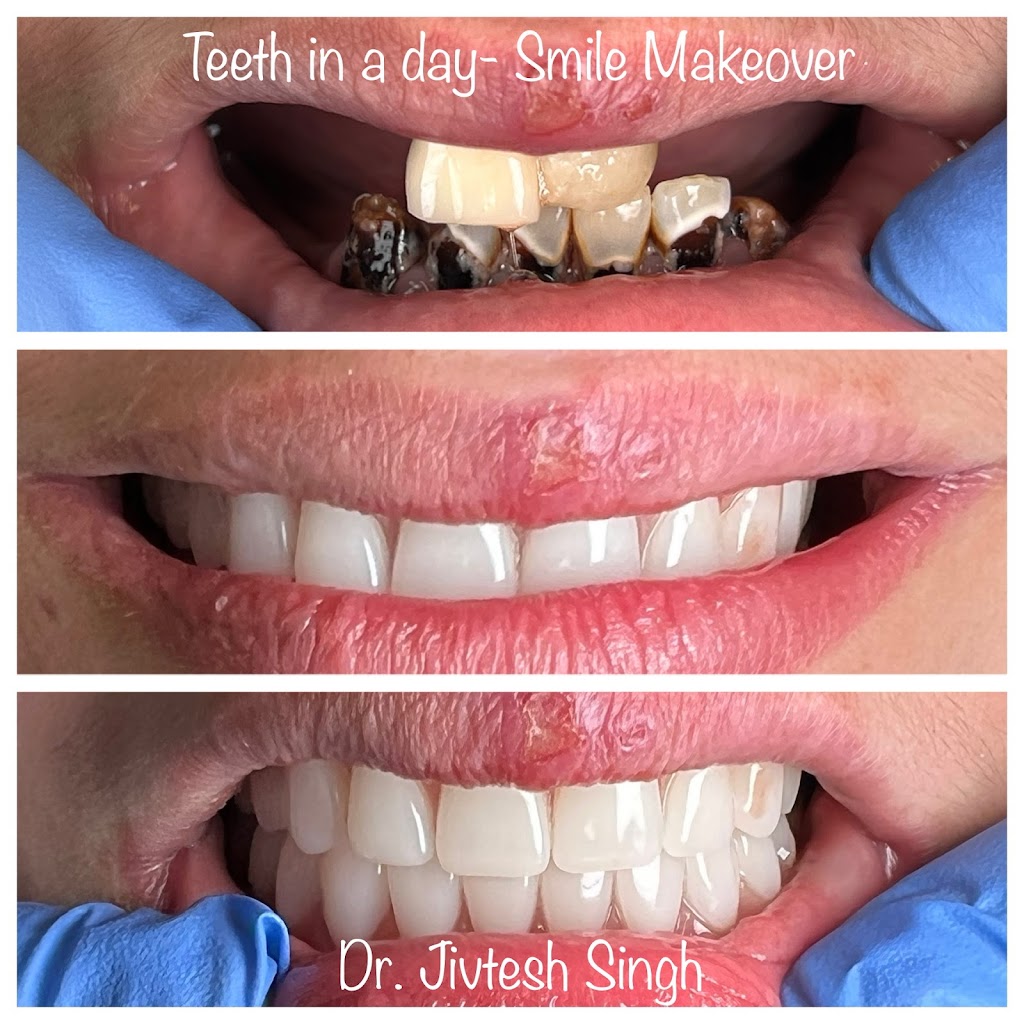 Dr. Jivtesh Singh, DDS | 499 William Floyd Pkwy, Shirley, NY 11967 | Phone: (631) 281-1440