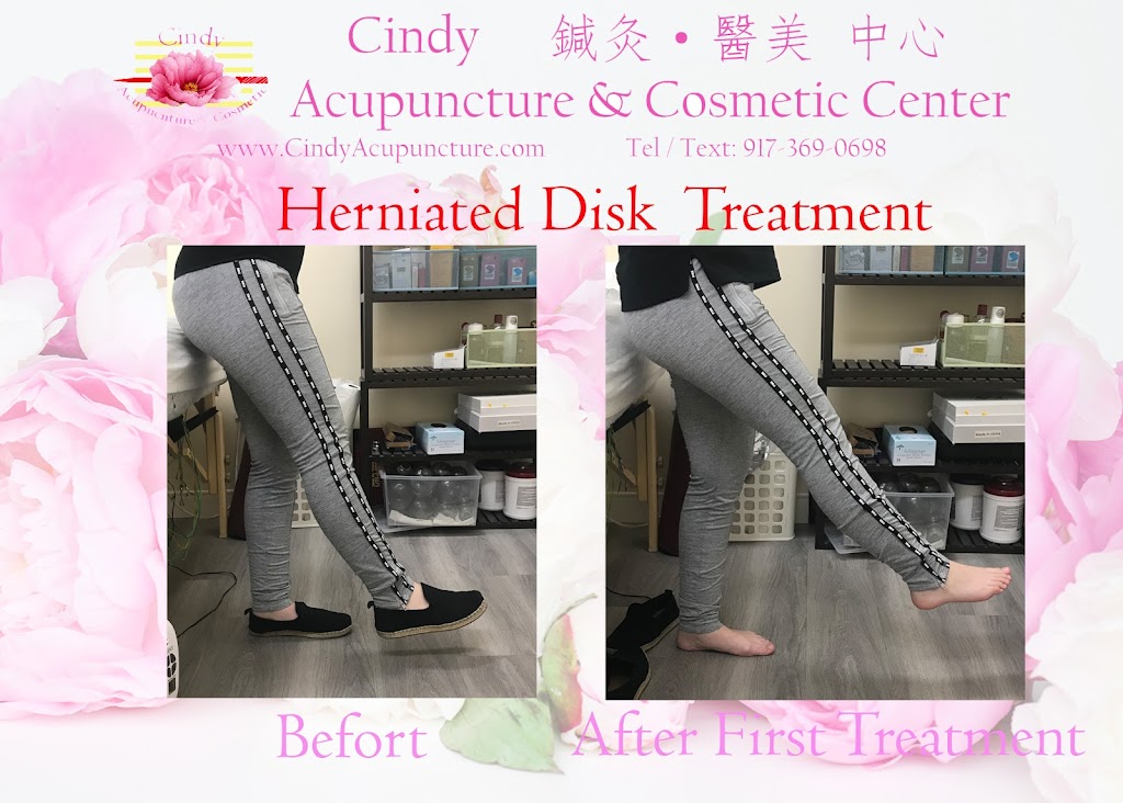 Chinese Acupuncture Rejuvenation Center By Cindy Hsieh-Ren | 504 Hamburg Turnpike #201, Wayne, NJ 07470 | Phone: (973) 960-2582