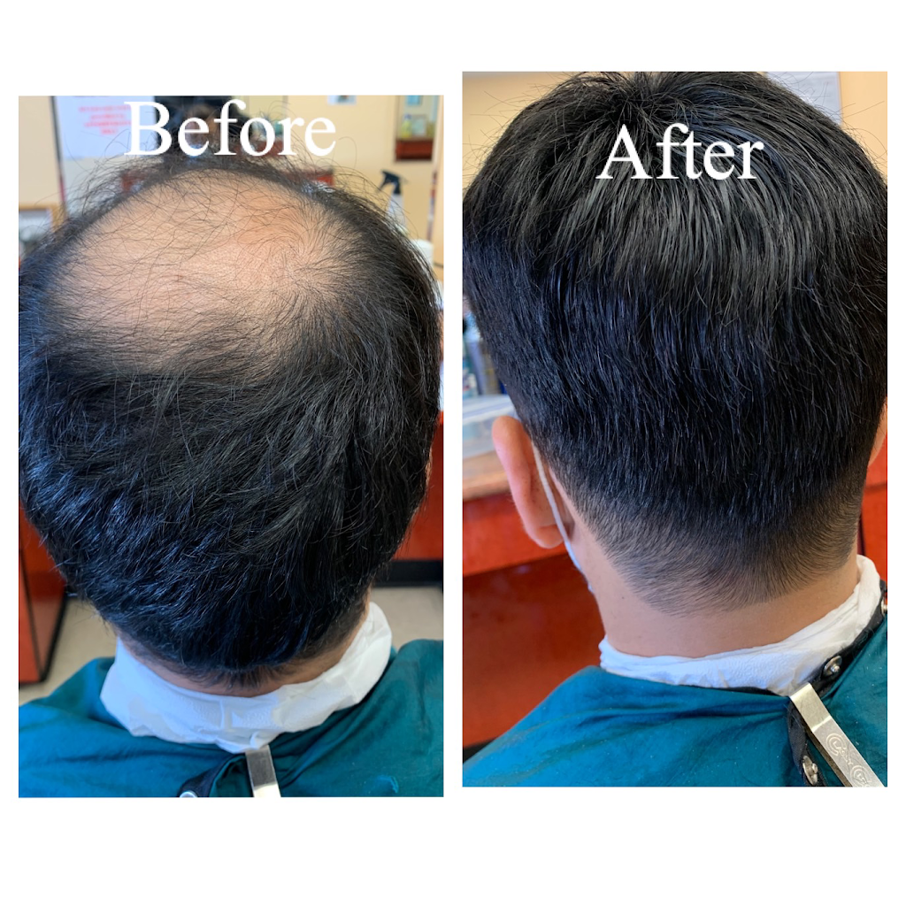 Ultimate Mens Hair Replacement | 2548 Merrick Rd, Bellmore, NY 11710 | Phone: (917) 435-8244