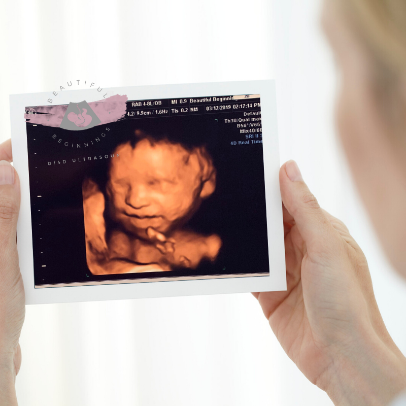 Beautiful Beginnings 3D Imaging | 969 Central Park Ave, Scarsdale, NY 10583 | Phone: (914) 574-5420