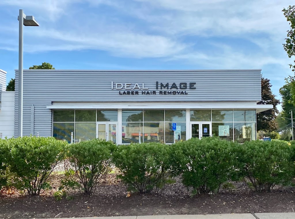 Ideal Image West Hartford | 1245 New Britain Ave, West Hartford, CT 06110 | Phone: (860) 308-1305