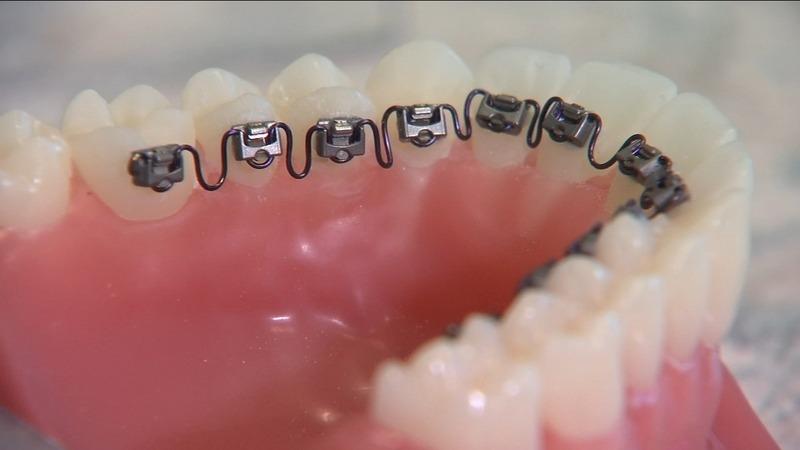 Yang Orthodontics - Invisalign & Braces in Langhorne | 310 Middletown Blvd #202, Langhorne, PA 19047 | Phone: (215) 757-0864