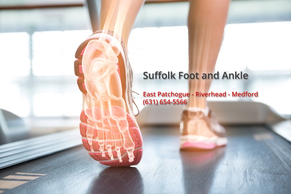 Suffolk Foot and Ankle | 1641 NY-112 suite a, Medford, NY 11763 | Phone: (631) 447-0800