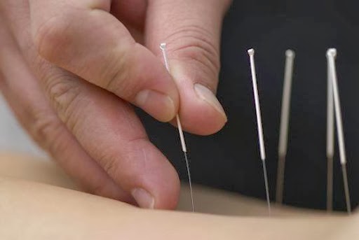 Mind Body Medicine Acupuncture | 6278 Northern Blvd Suite 1, East Norwich, NY 11732 | Phone: (516) 945-9565