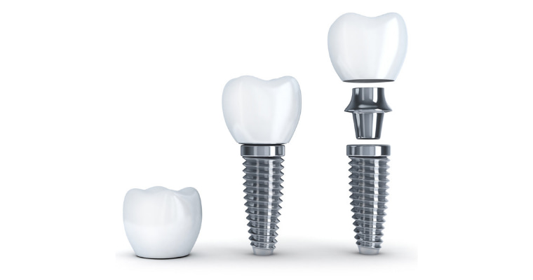 Implant Denture LLC | 689 E 31st St, Paterson, NJ 07513 | Phone: (973) 787-5743