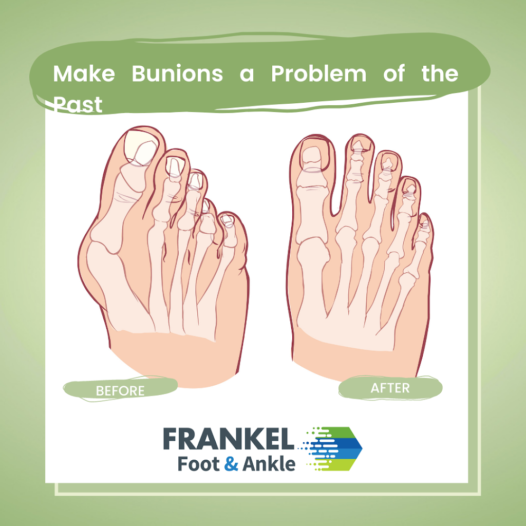 Frankel Foot & Ankle Center - Warwick Office | 2 Overlook Dr, Warwick, NY 10990 | Phone: (845) 343-6050