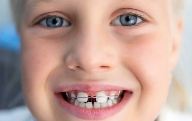 CDF Family Orthodontics | 1 Chesley Dr, Media, PA 19063 | Phone: (610) 566-6649