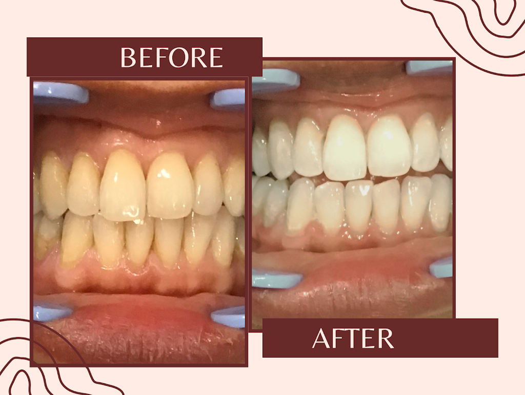 GPS Teeth Whitening | 400 Universal Dr, North Haven, CT 06473 | Phone: (860) 776-4612