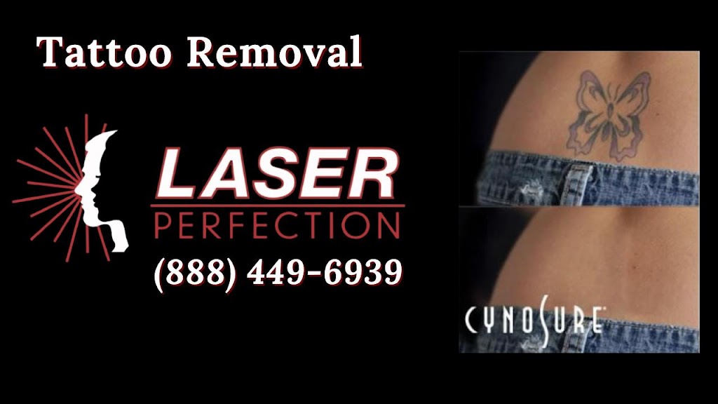 Laser Perfection | 2981 Grant Ave, Philadelphia, PA 19114 | Phone: (888) 449-6939