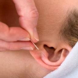 Acupuncture Center [Reproductive * Pain Relief * Family] | 14 Church St, Basking Ridge, NJ 07920 | Phone: (908) 719-1362