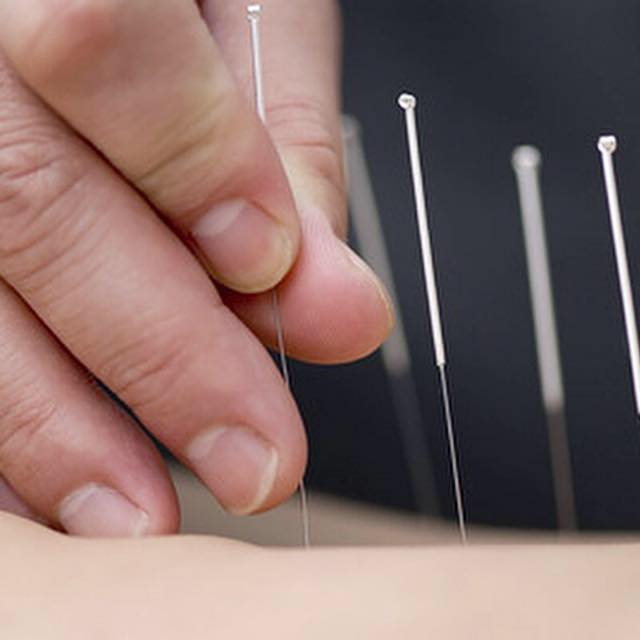 Acupuncture Practice of Robert F. Lenahan | 3402 River Rd, Point Pleasant, NJ 08742 | Phone: (732) 899-0951