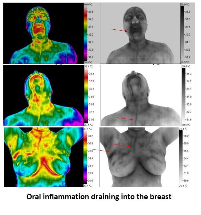 B Well Thermography | 39 Naugatuck Ave, Milford, CT 06460 | Phone: (475) 271-1066