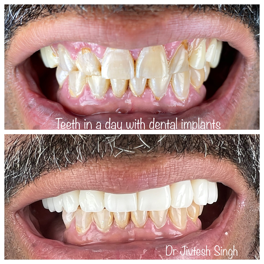 A & B Dental - Cosmetic and Implant Dentistry | 499 William Floyd Pkwy, Shirley, NY 11967 | Phone: (631) 281-1440