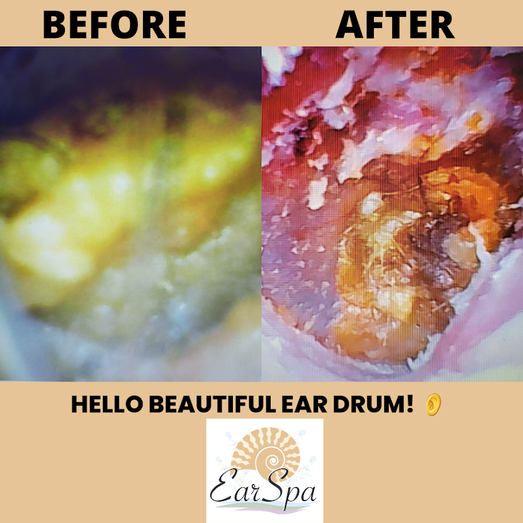 EarSpa | 17 Clinton Ave, Eatontown, NJ 07724 | Phone: (347) 695-6309