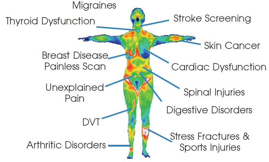 B Well Thermography LLC | Satellite Locations, 2301 Berlin Turnpike, Newington, CT 06111 | Phone: (203) 915-9712