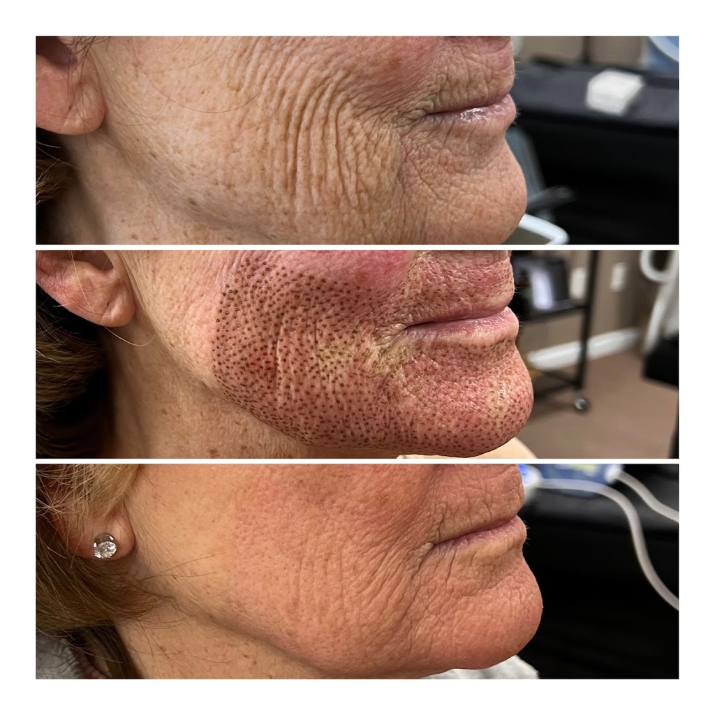 Ageless Aesthetics by HB Walsh | 1 Pelican Dr #2, Bayville, NJ 08721 | Phone: (848) 992-3157