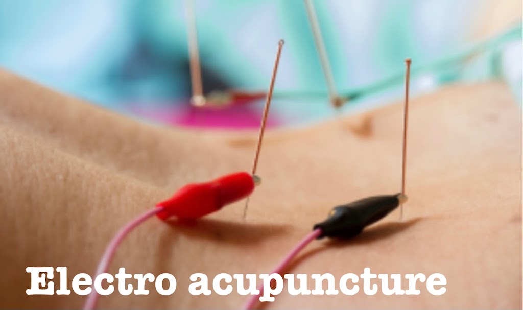 OnPoint Acupuncture | 409 Cedar Ln, Teaneck, NJ 07666 | Phone: (551) 486-4220