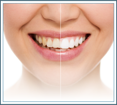 Lasting Smiles of Bethlehem | 2299 Brodhead Rd STE K, Bethlehem, PA 18020 | Phone: (610) 861-0777