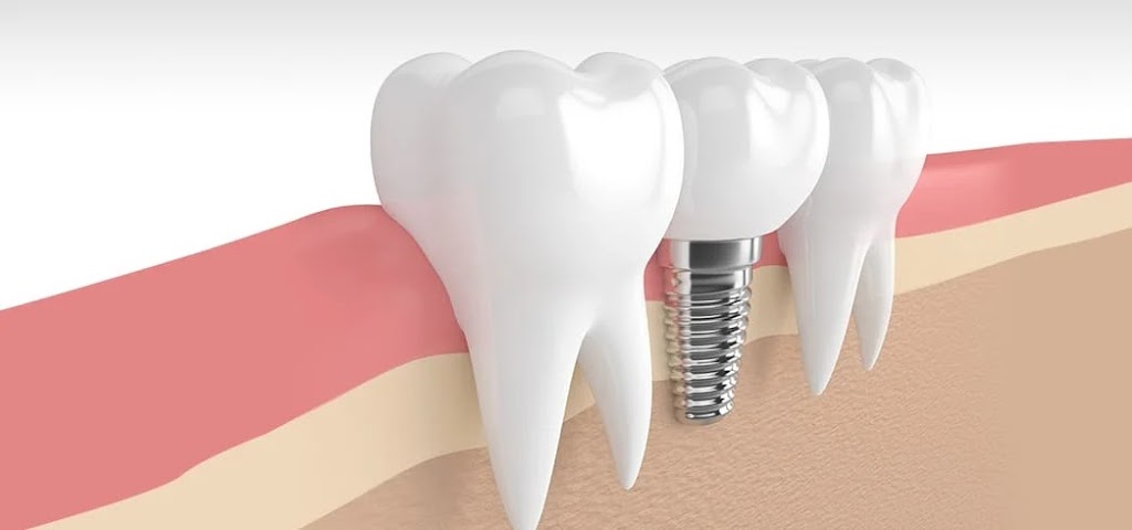 Implant Denture LLC | 689 E 31st St, Paterson, NJ 07513 | Phone: (973) 787-5743