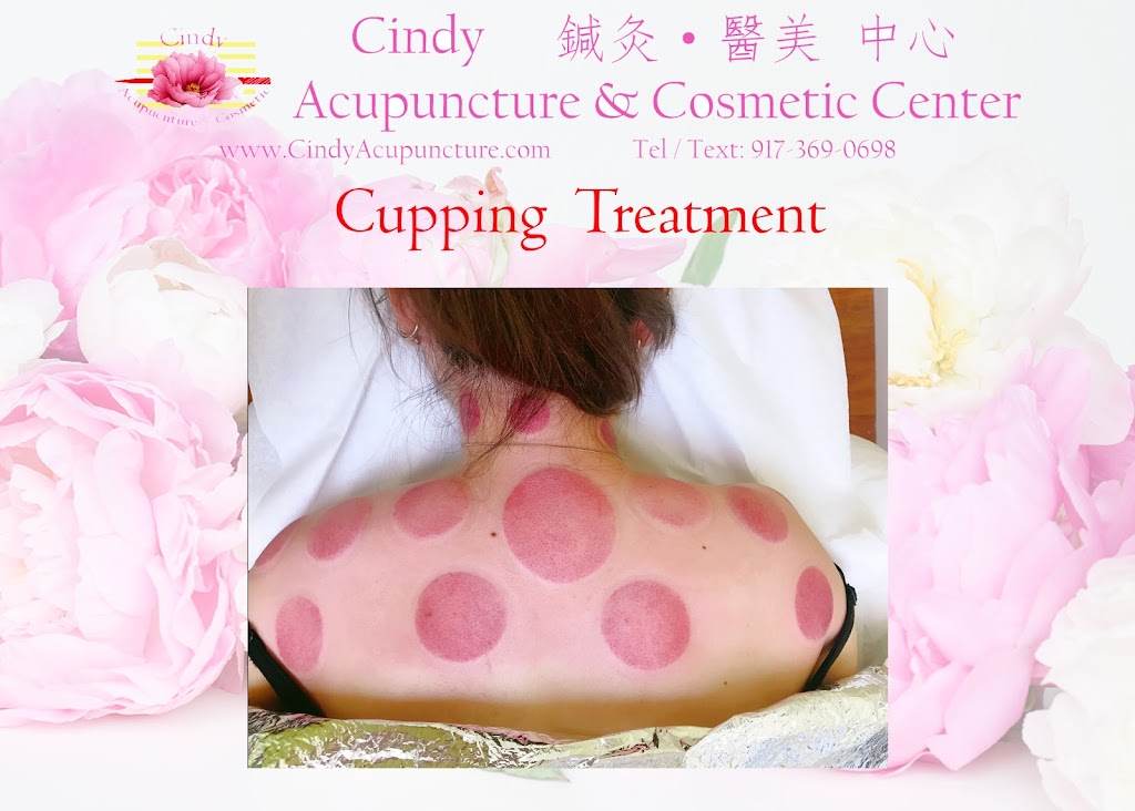 Chinese Acupuncture Rejuvenation Center By Cindy Hsieh-Ren | 504 Hamburg Turnpike #201, Wayne, NJ 07470 | Phone: (973) 960-2582