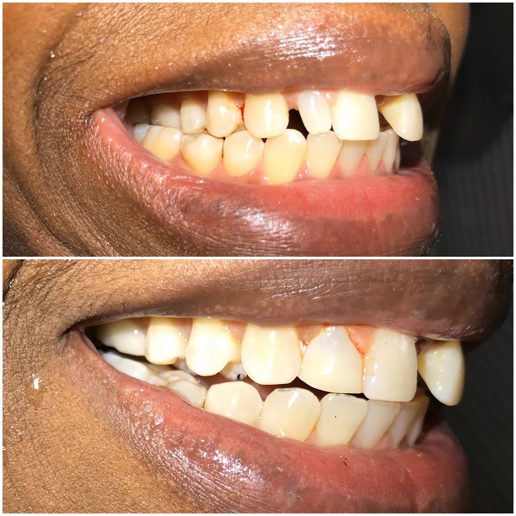Perfect Smile Dental | 55 Old Nyack Turnpike Suite 103, Nanuet, NY 10954 | Phone: (845) 623-0710