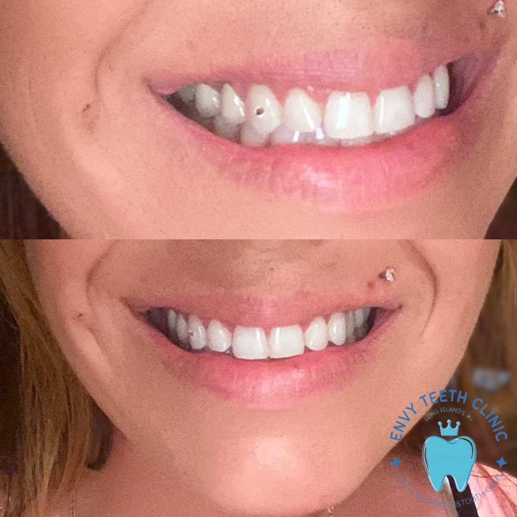 Lash Envy & Teeth Whitening | 765 NY-25A #4, Miller Place, NY 11764 | Phone: (631) 647-0535