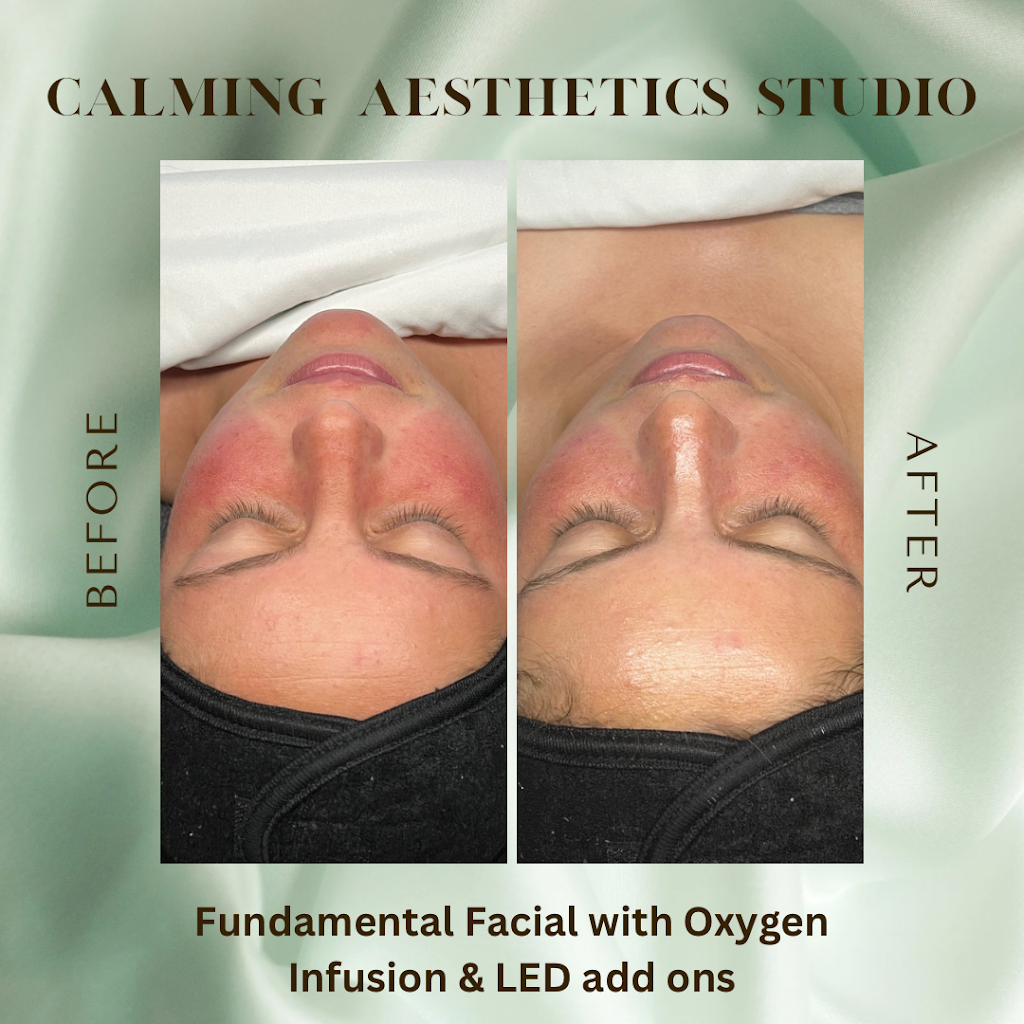 Calming Aesthetics Studio | 1070 Middle Country Rd # 16, Selden, NY 11784 | Phone: (631) 238-1039