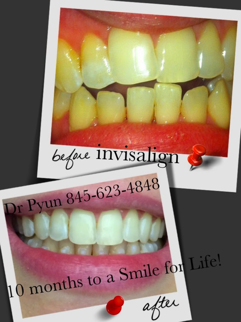 Smile for Life Family & Cosmetic Dental | 27 Townline Rd, Pearl River, NY 10965 | Phone: (845) 623-4848
