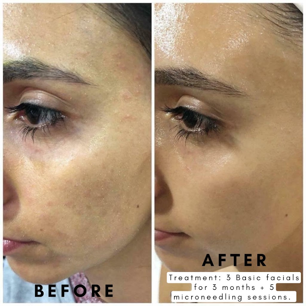 Skin Perfect By Dayna | 345 Heather Ct, Yorktown Heights, NY 10598 | Phone: (914) 215-0197