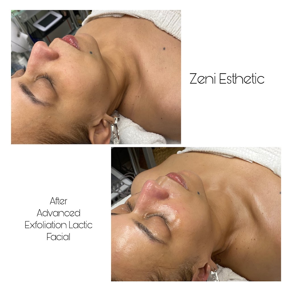 Zeni Esthetics, LLC | 91 Schraffts Dr STE 5, Waterbury, CT 06705 | Phone: (203) 768-5739