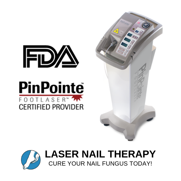 Laser Nail Therapy | 87-15 37th Ave, Queens, NY 11372 | Phone: (917) 633-4338