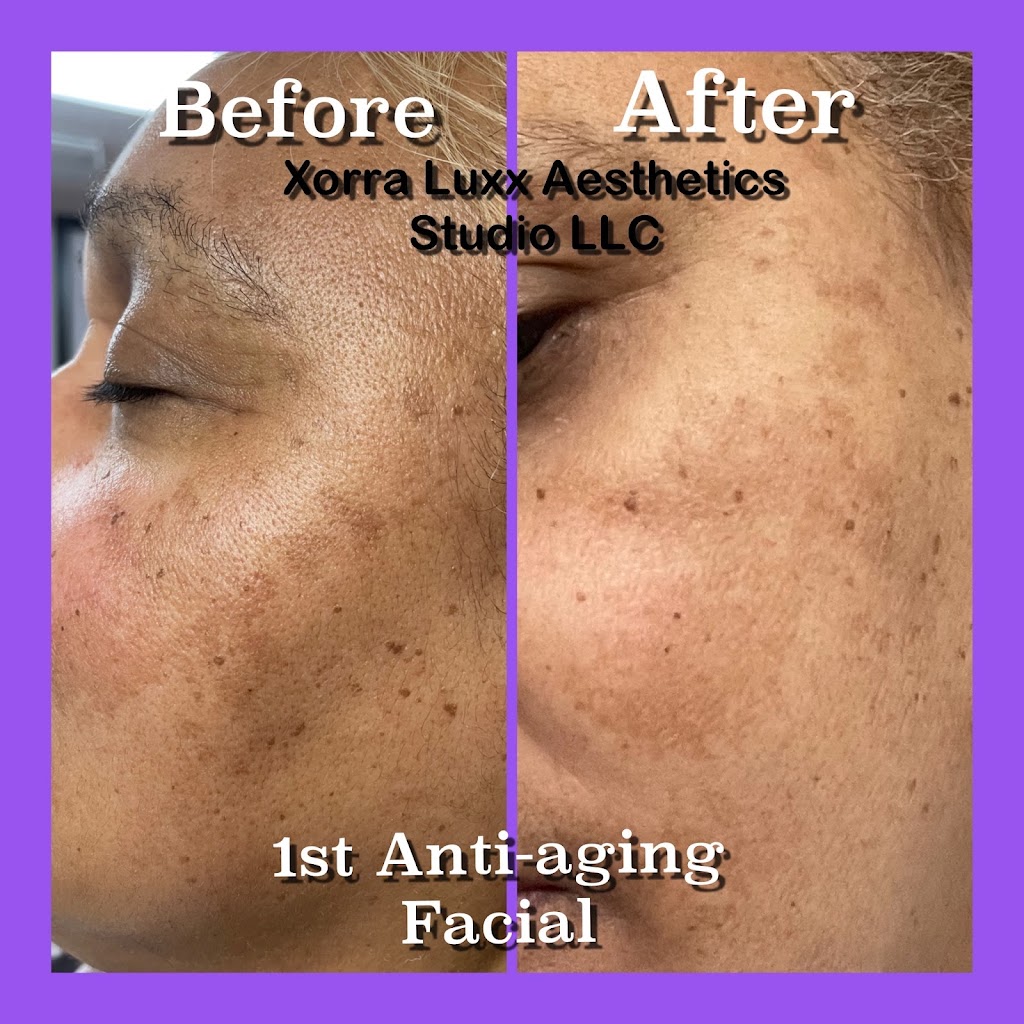 Xorra Luxx Aesthetics Studio LLC | 1243 Hopmeadow St, Simsbury, CT 06070 | Phone: (860) 461-6931