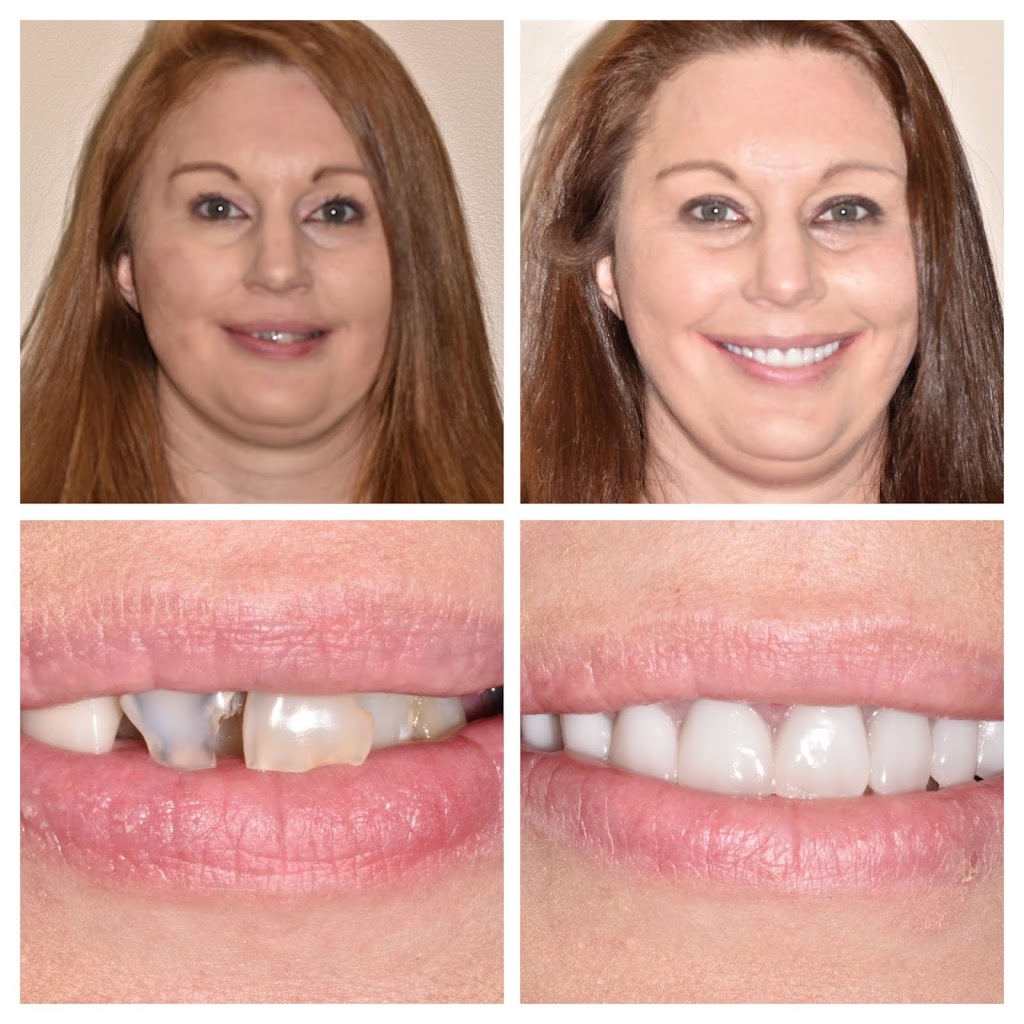 Chester County Prosthodontics | 1217 West Chester Pike, West Chester, PA 19382 | Phone: (610) 436-9570