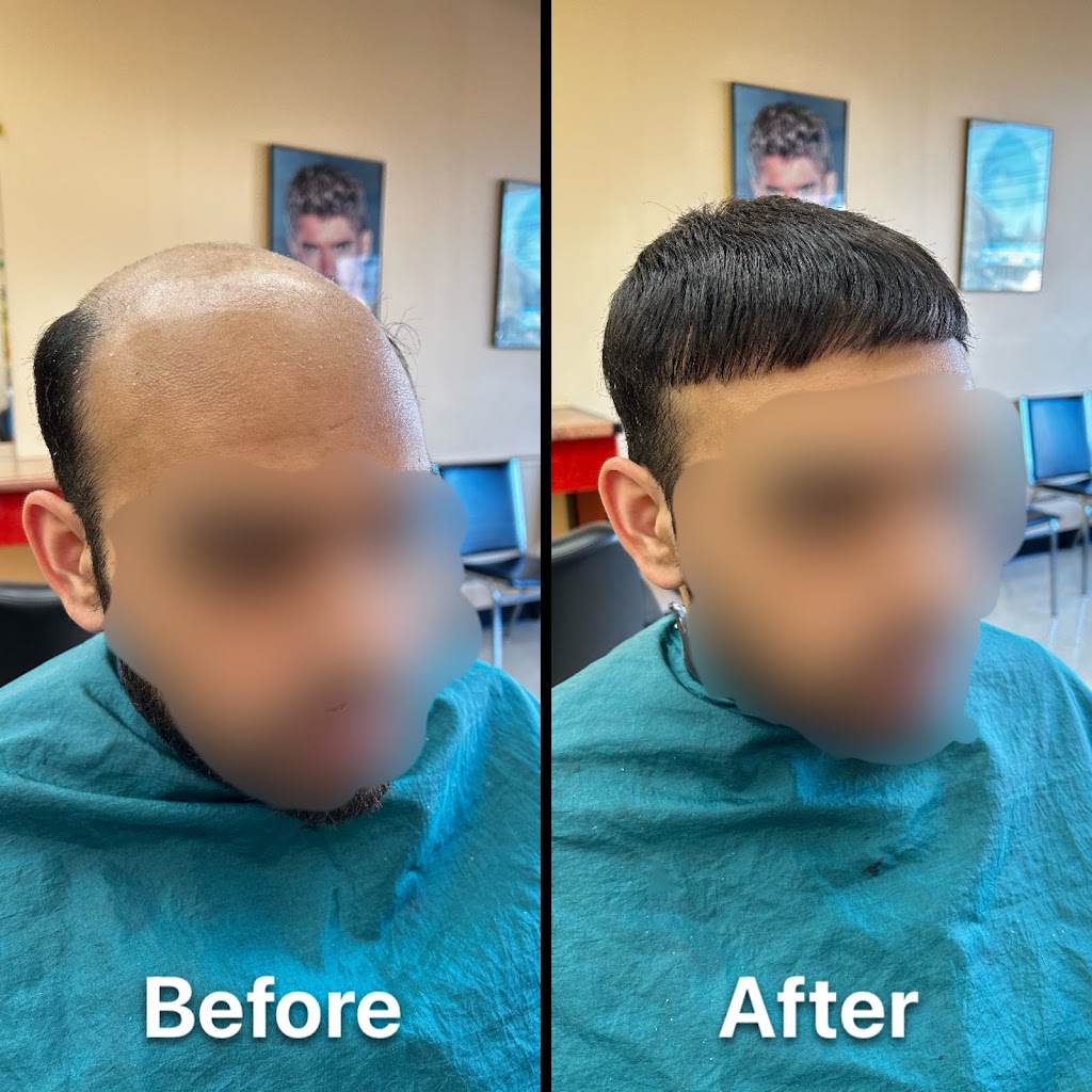 Ultimate Mens Hair Replacement | 2548 Merrick Rd, Bellmore, NY 11710 | Phone: (917) 435-8244