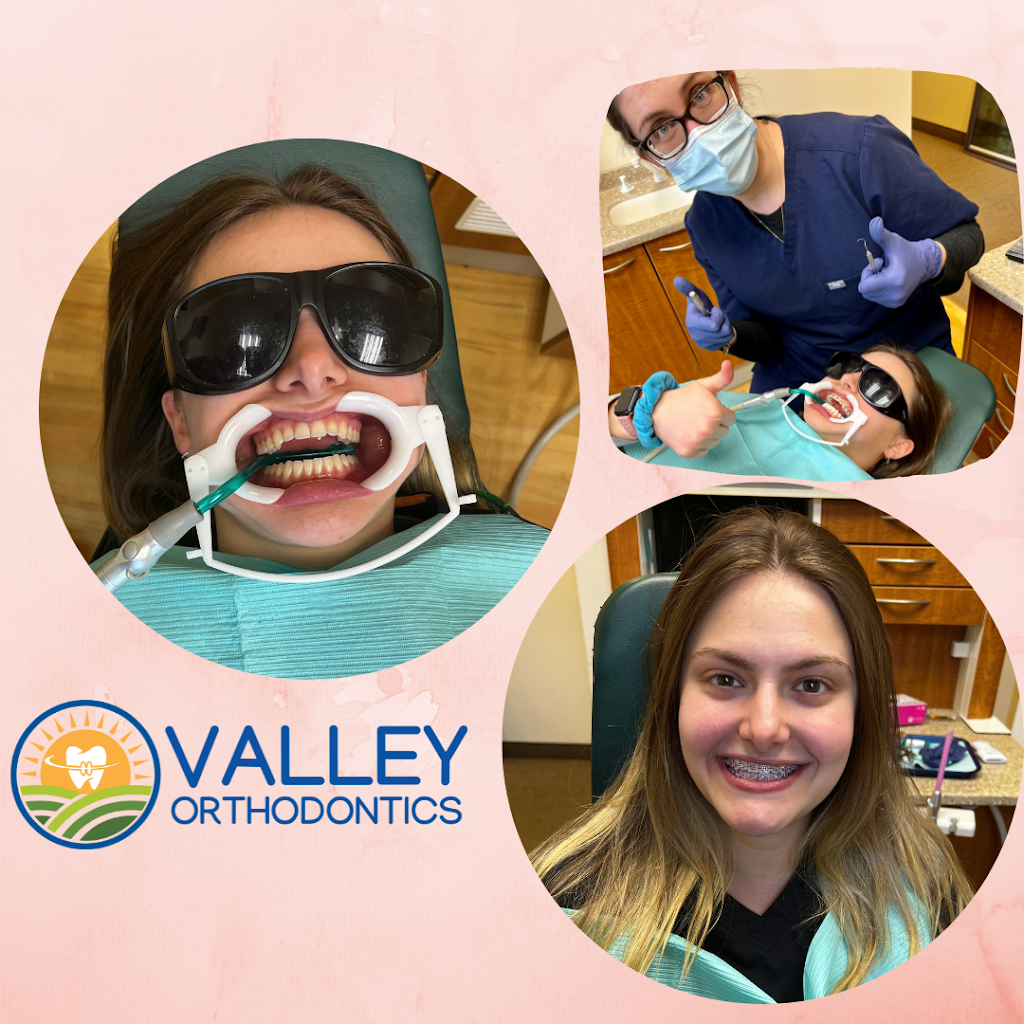 Valley Orthodontics | 3630 Hill Blvd STE 101, Jefferson Valley, NY 10535 | Phone: (914) 245-7100