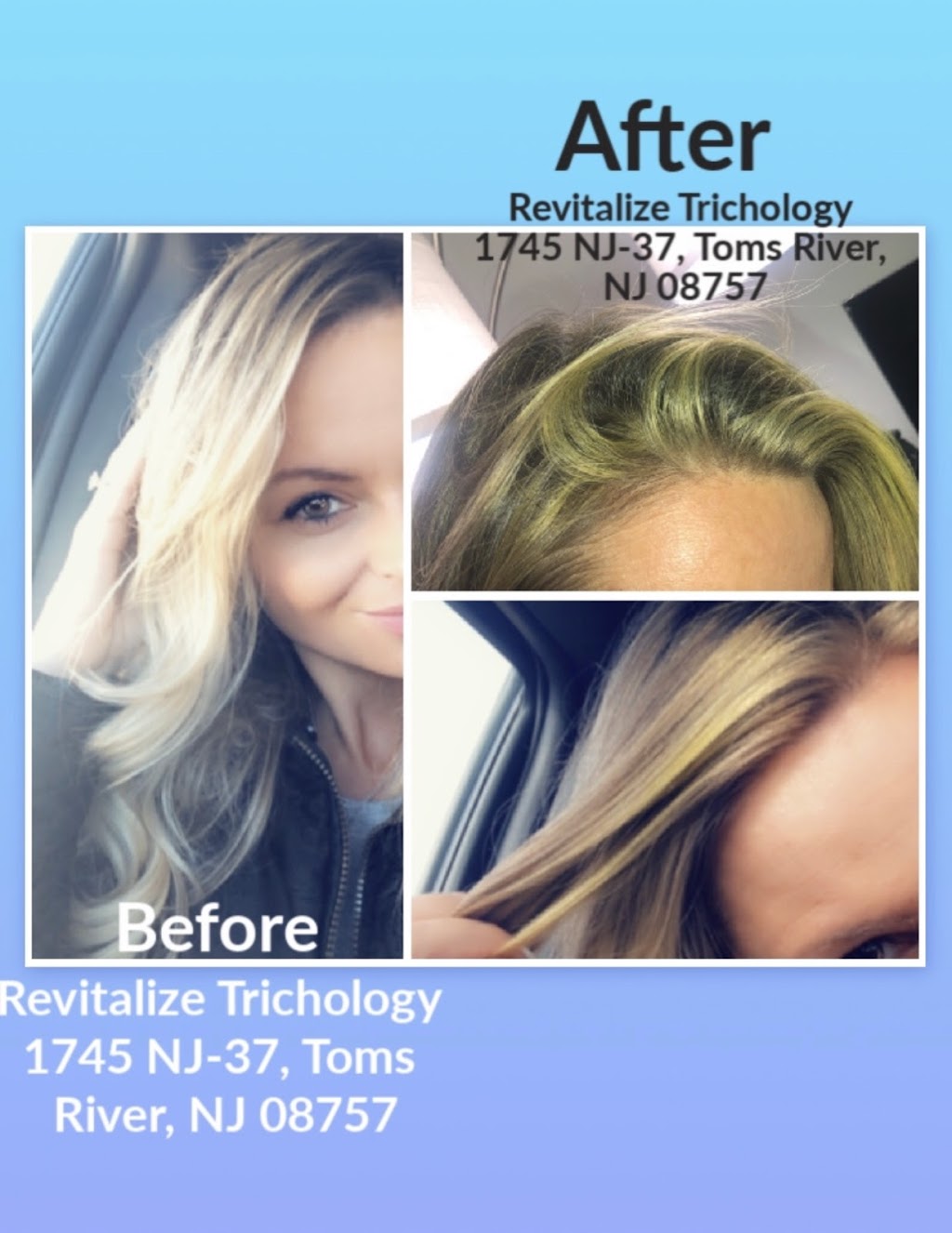 Revitalize Trichology Hair loss and scalp rejuvenation center | 1745 NJ-37 W, Toms River, NJ 08757 | Phone: (609) 384-2611