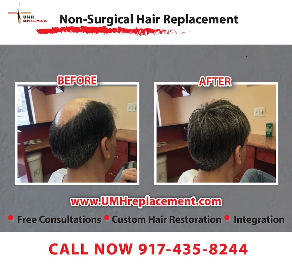 Ultimate Mens Hair Replacement | 2548 Merrick Rd, Bellmore, NY 11710 | Phone: (917) 435-8244