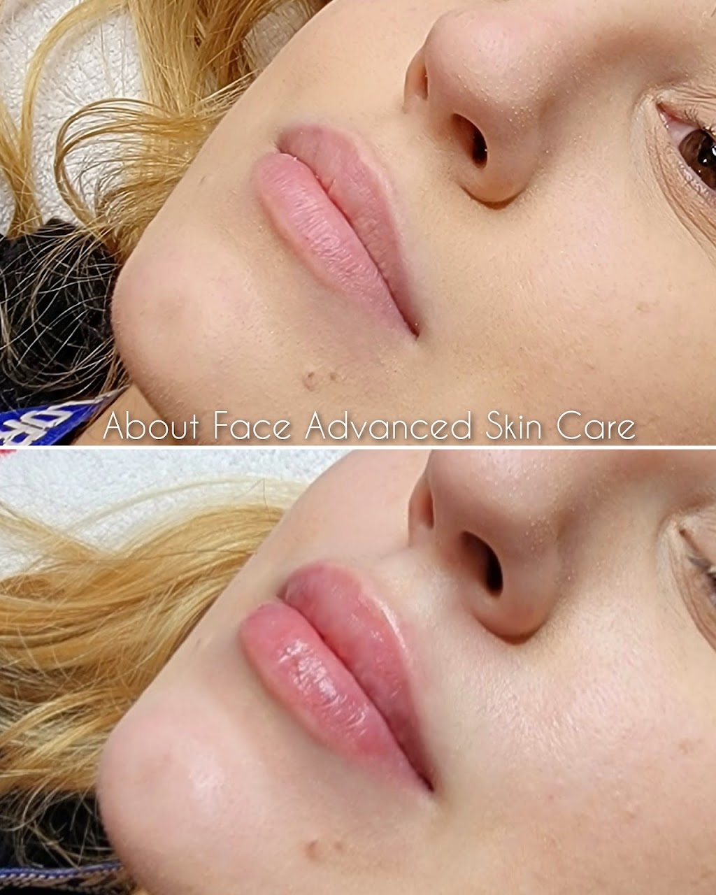 About Face Advanced Skin Care | 13 Tunxis St Unit C, Windsor, CT 06095 | Phone: (860) 878-9010
