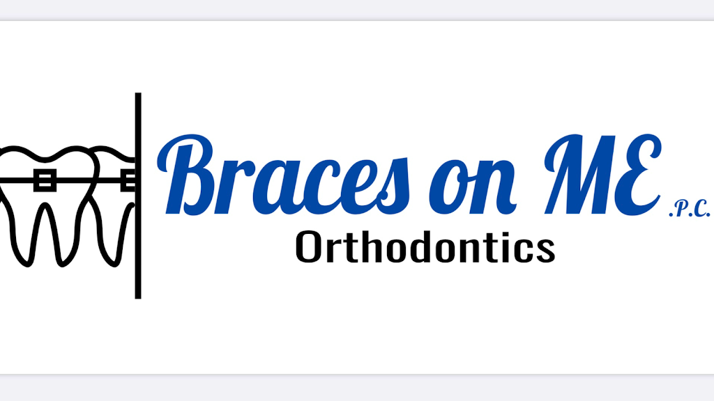 Braces on ME | 209 Boston Post Rd Suite 312, Milford, CT 06460 | Phone: (203) 876-9965
