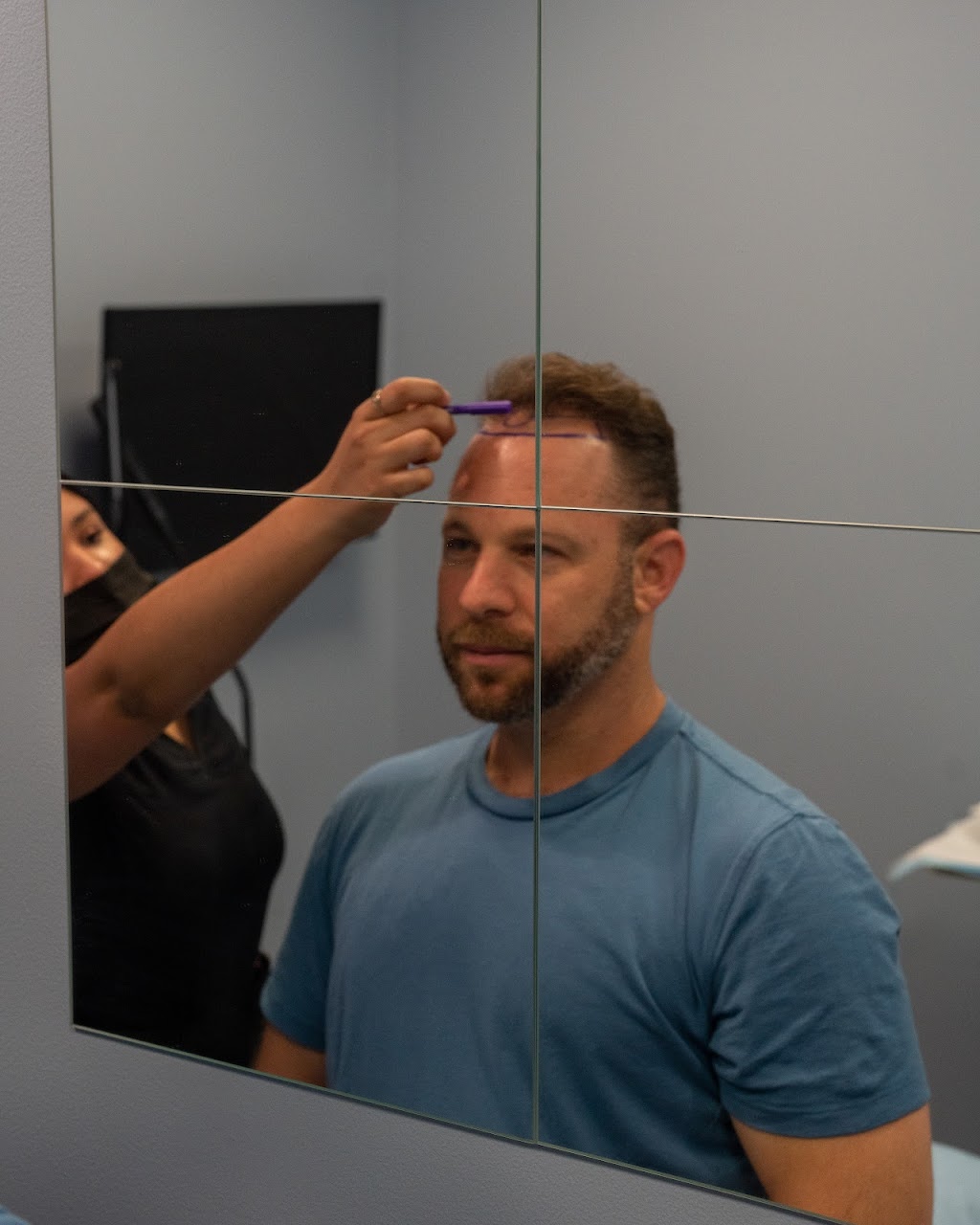 FUE Hair Transplant Solution New Jersey | 4057 Asbury Ave Suite 021, Tinton Falls, NJ 07753 | Phone: (848) 420-9970
