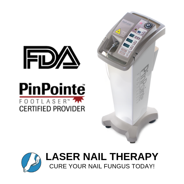 Laser Nail Therapy | 43 Grand St, Kingston, NY 12401 | Phone: (845) 200-3475