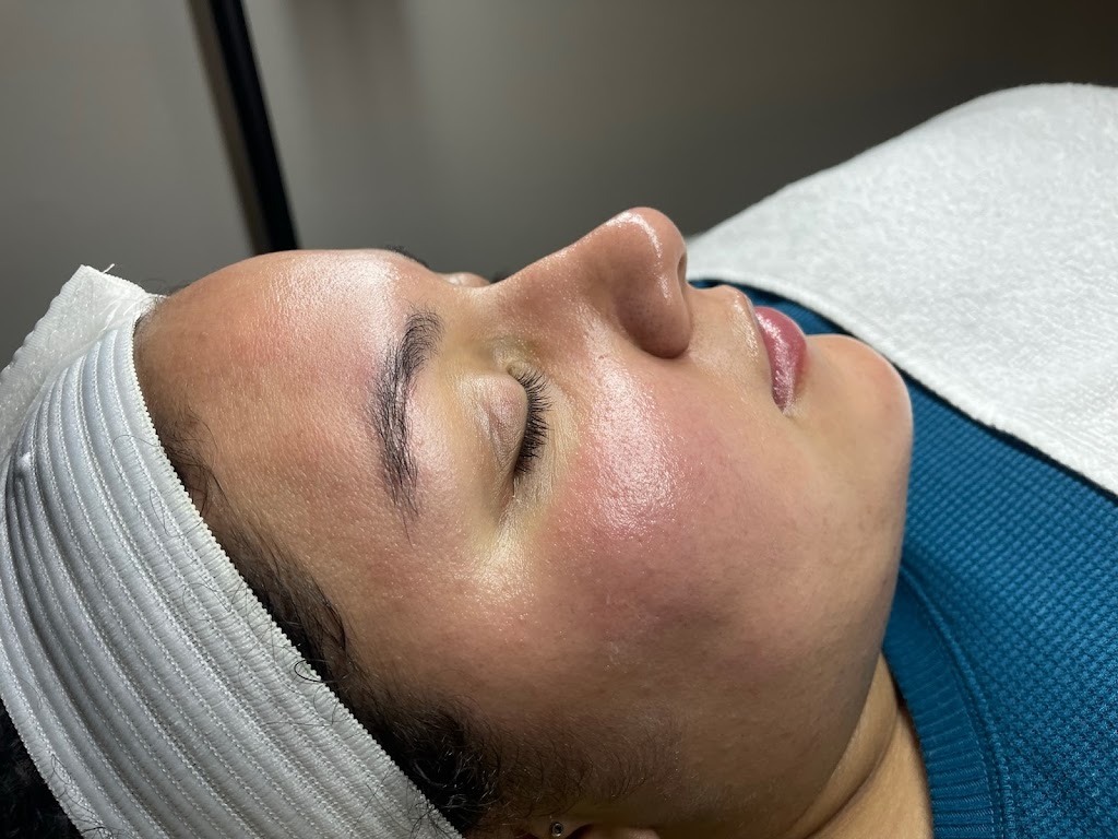 On The Glow Skincare Studio | 631 Middletown Ave, New Haven, CT 06513 | Phone: (203) 444-9140