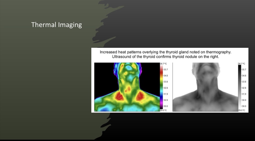 B Well Thermography | 39 Naugatuck Ave, Milford, CT 06460 | Phone: (475) 271-1066